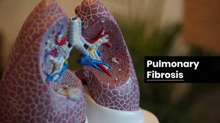 Pulmonary fibrosis treatment